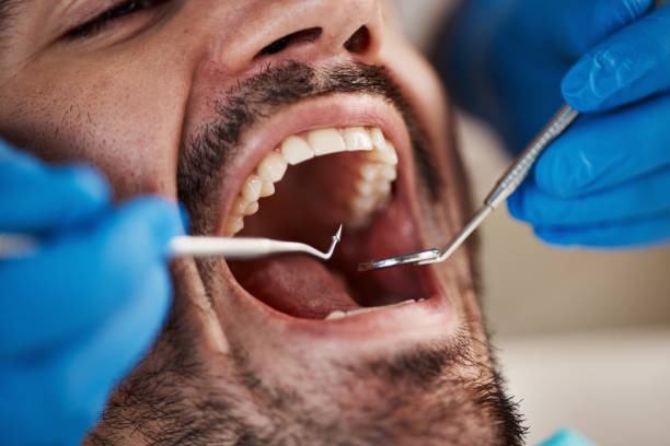 Best Emergency Dentist for Knocked-Out Tooth in Bellevue, PA